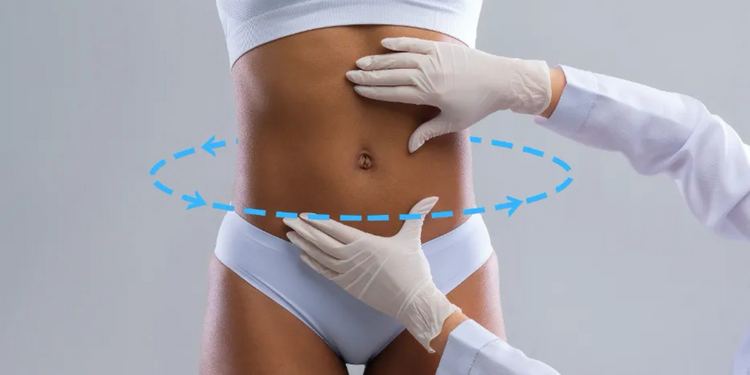 Liposuction & BBL (Brazilian Butt Lift)